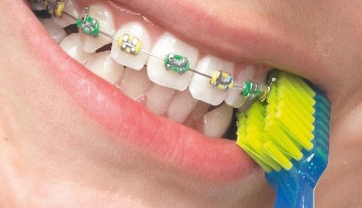 V-образная зубная щетка V-образная зубная щетка